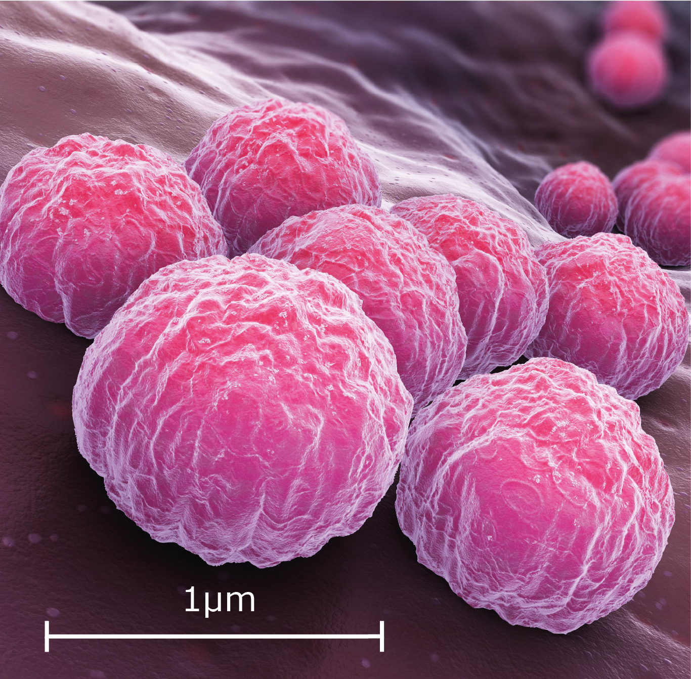 Chlamydia Sq Scale