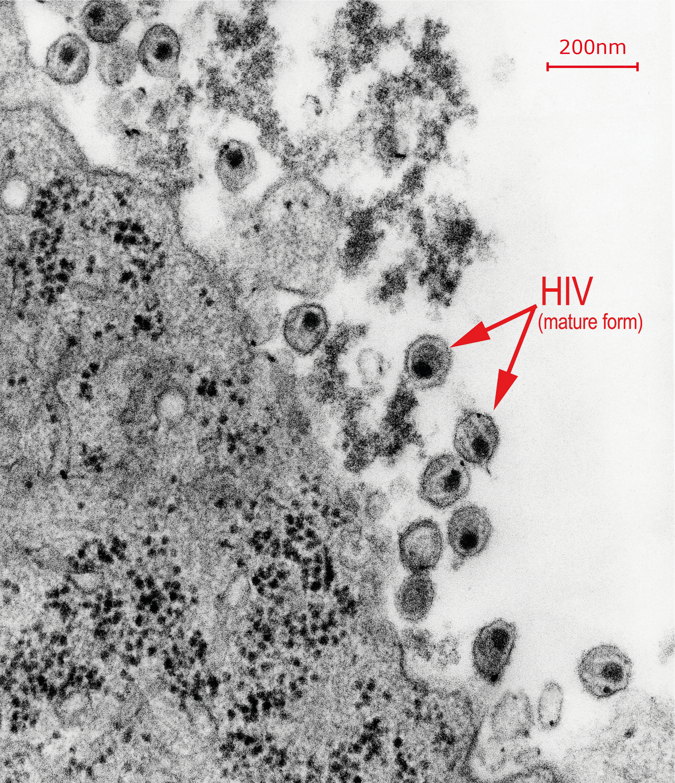 Hiv Mature Scale