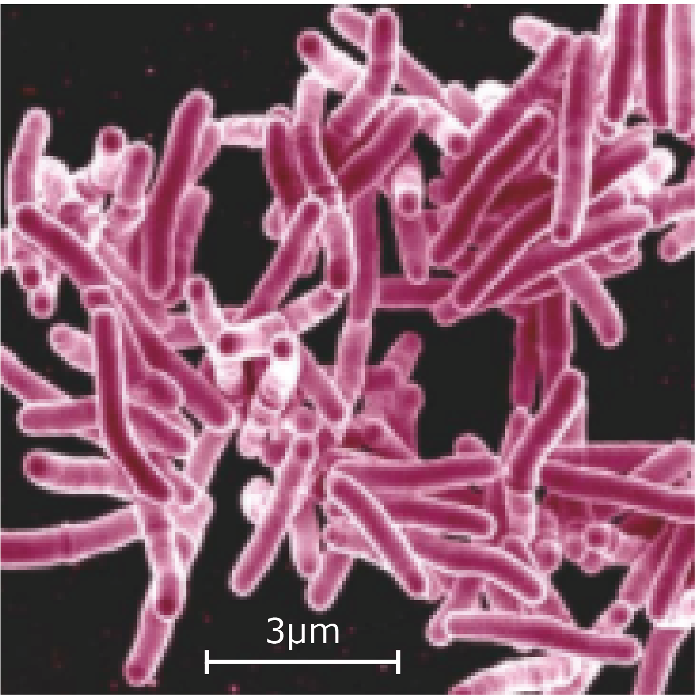 Tuberculosis Sq Scale