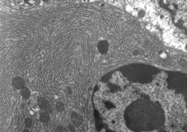 Transmission Electron Micrograph Cells