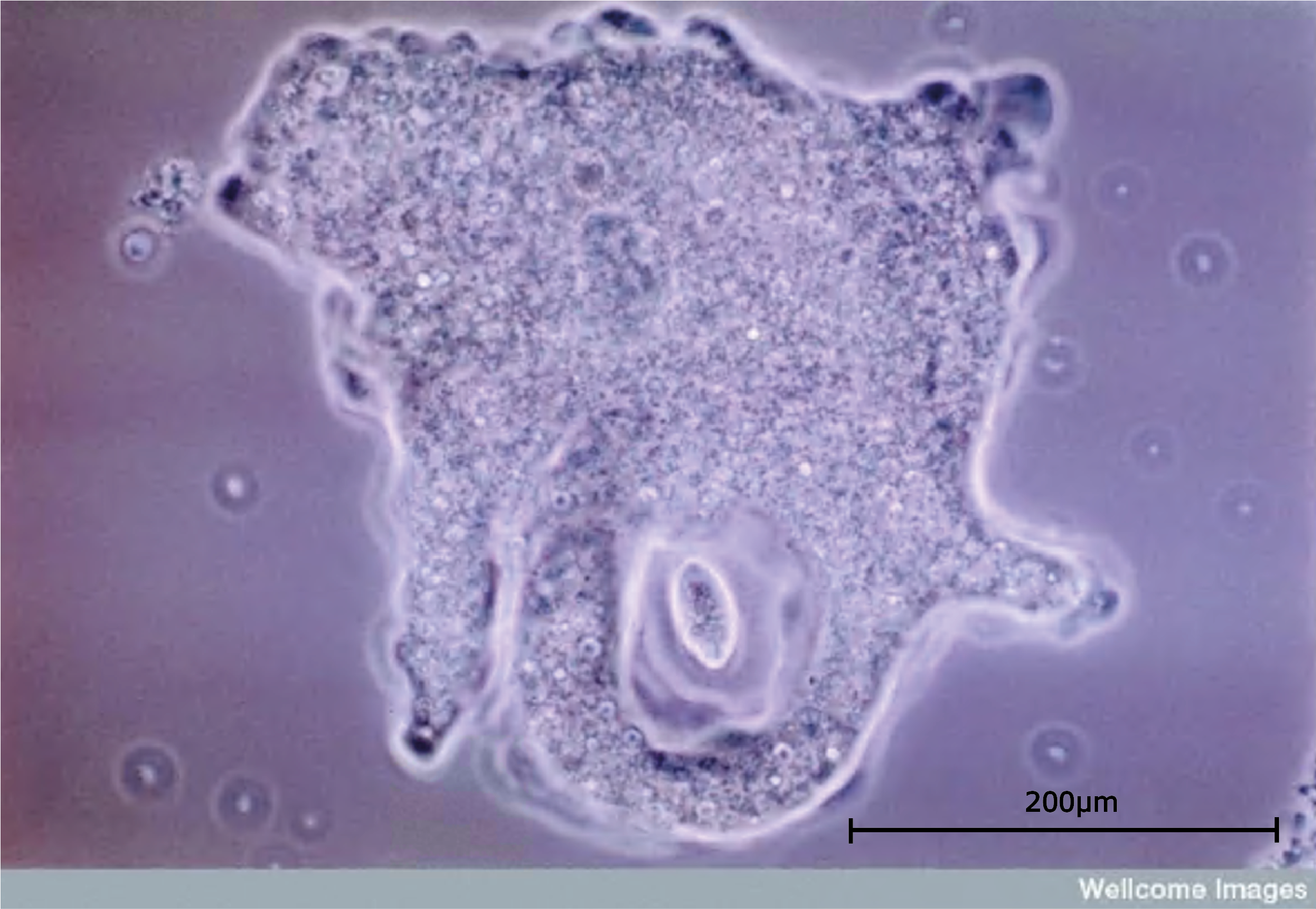 Amoeba Scale