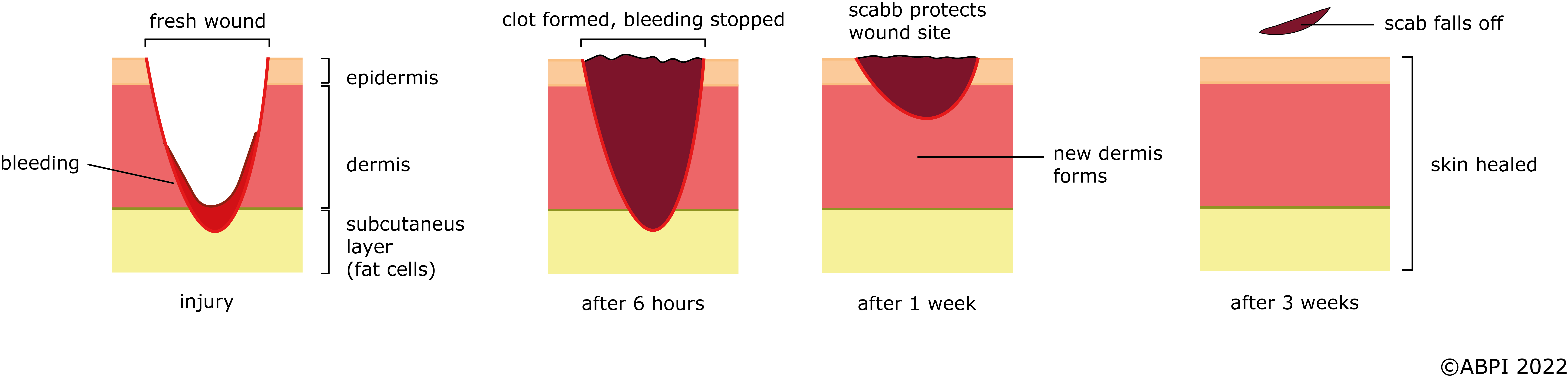 Wound Healing JSU